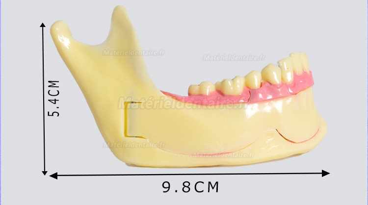Modèle anatomique dentaire de décomposition du tissu osseux frontal inférieur