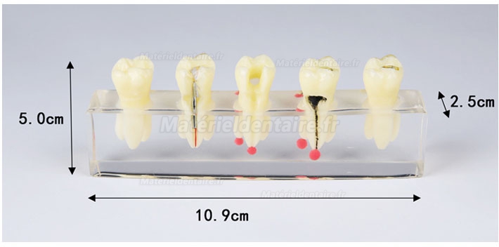 Modèle de pathologie canalaire