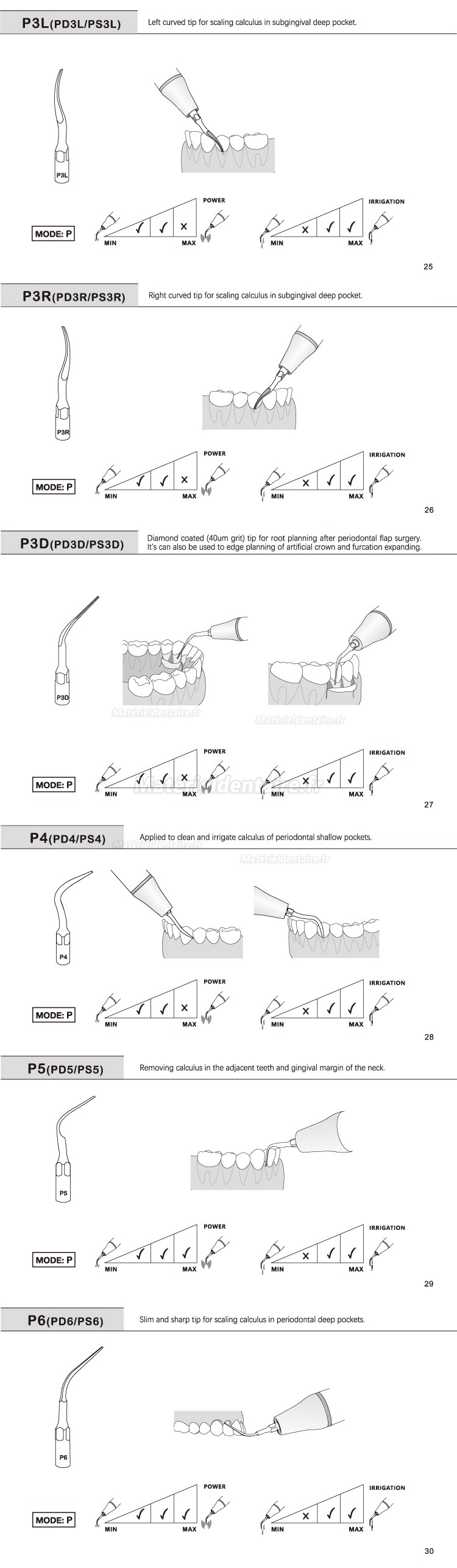 5 Pièces Refine® Inserts piézo pour la parodontologie P2L P2R P2LD P2RD P5 P6 P7 P8 P10 P11 P12 P14L compatible avec EMS Woodpecker