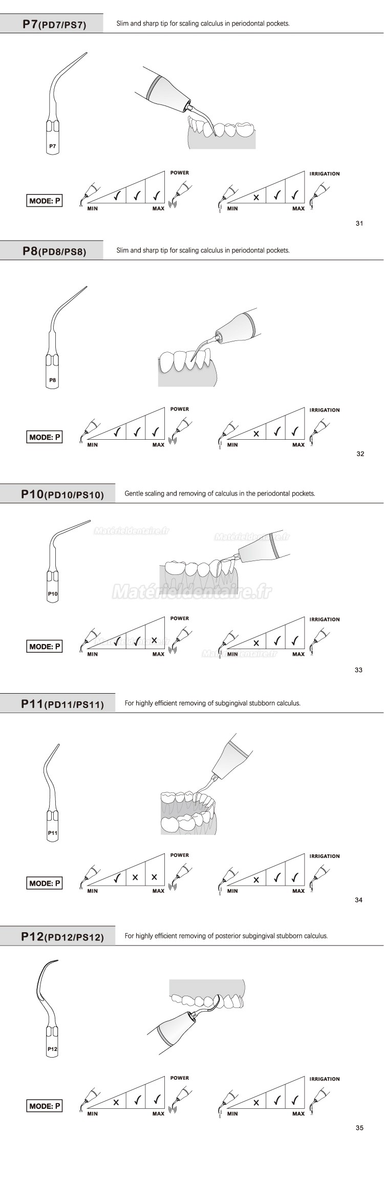 5 Pièces Refine® Inserts piézo pour la parodontologie P2L P2R P2LD P2RD P5 P6 P7 P8 P10 P11 P12 P14L compatible avec EMS Woodpecker