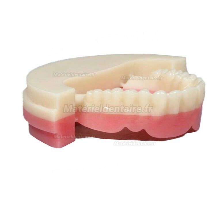 5 Pièces OD98*25mm Disques PMMA dentaire (bicolore A2 + rose matériau PMMA)