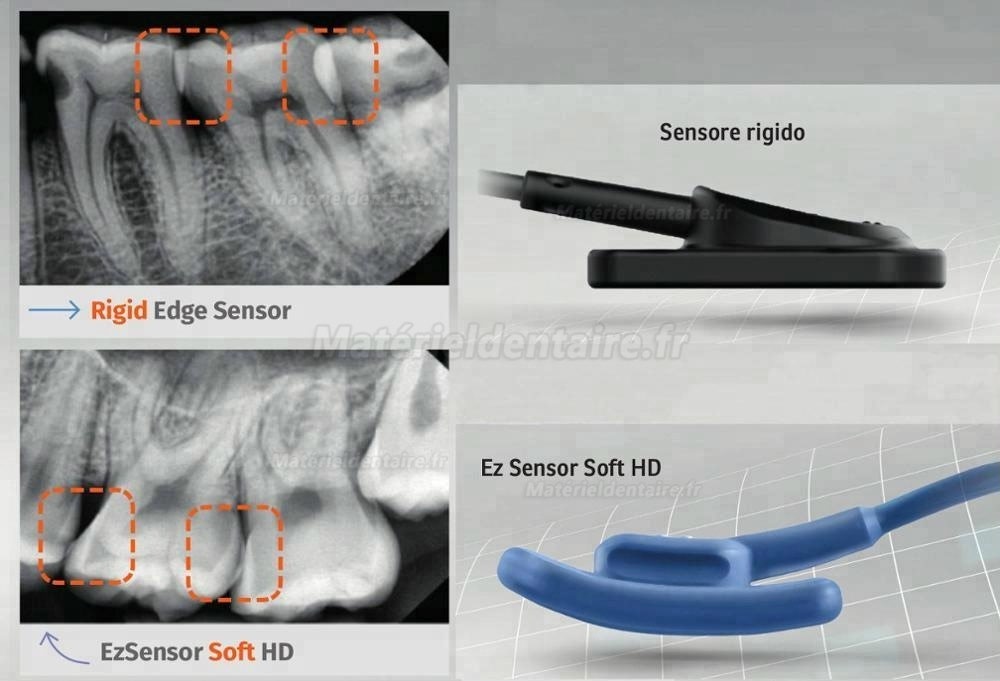 VATECH EZSensor Capteur dentaire à rayons X de type souple VATECH EZSensor Capteur dentaire à rayons X de type souple