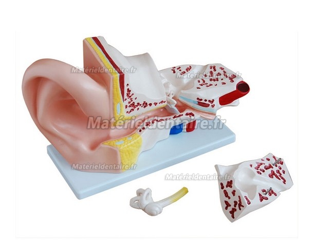 Modèle anatomique d’oreille 5 fois grandeur 4 pièces XC-303A